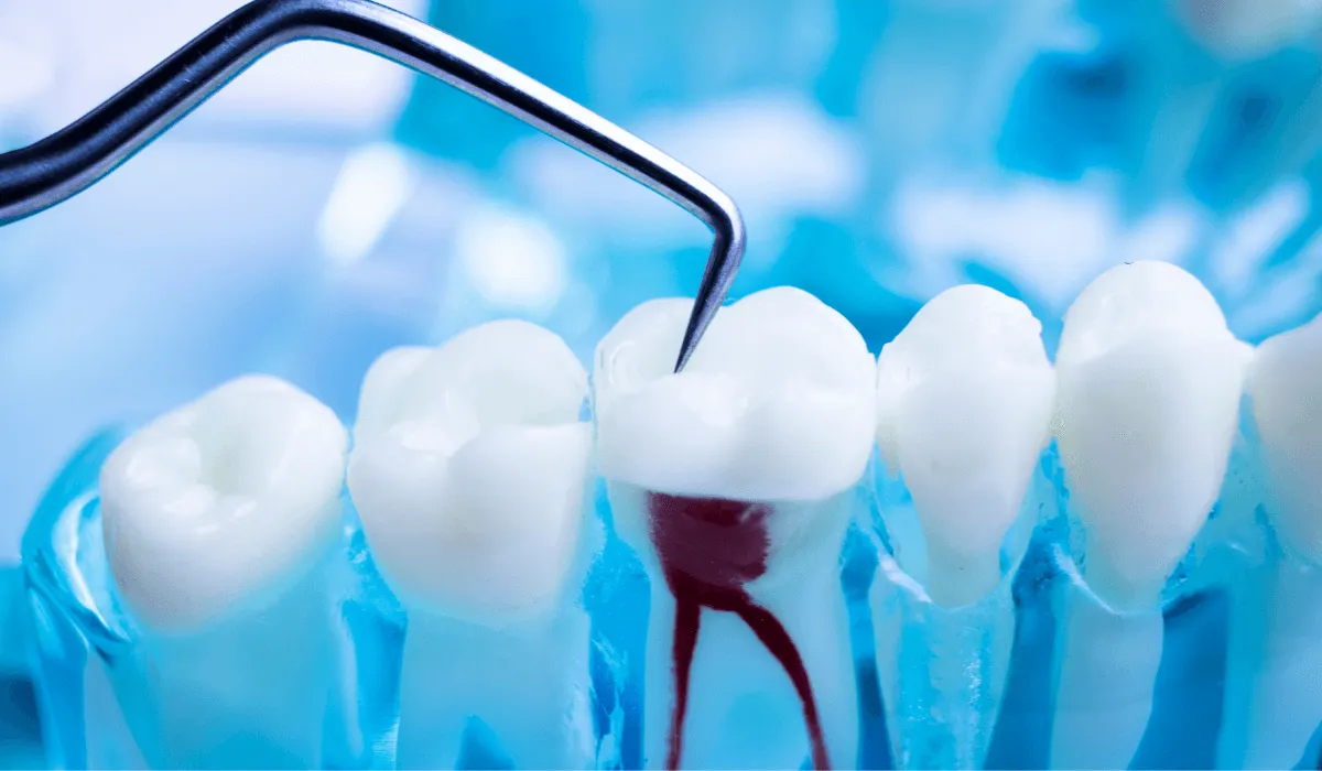 Clinica dental especializada en endodoncia Vitoria