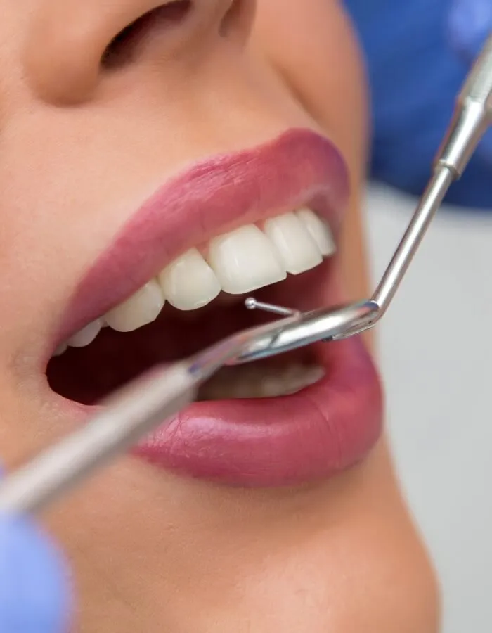 estetica dental vitoria voltas estetica dental vitoria voltas